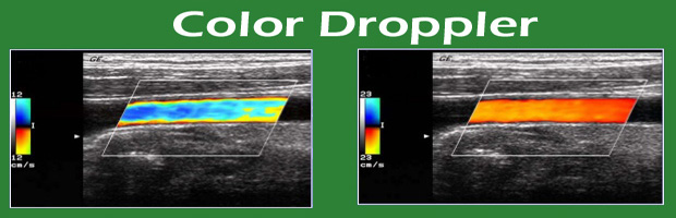 COLOR DOPPLER